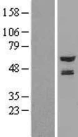 Novus Biologicals&trade;&nbsp;NMT2 Overexpression Lysate