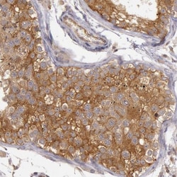 NMT2 Antibody, Novus Biologicals:Antibodies:Primary Antibodies