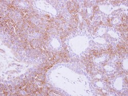 Neuromedin UR1/NMUR1 Antibody, Novus Biologicals 0.1mL; Unlabeled:Antibodies,