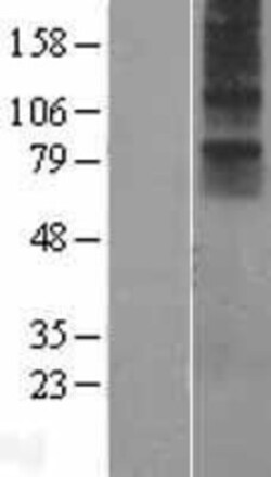Novus Biologicals&trade;&nbsp;Neuromedin UR1/NMUR1 Overexpression Lysate