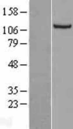 Novus Biologicals&trade;&nbsp;NNT Overexpression Lysate