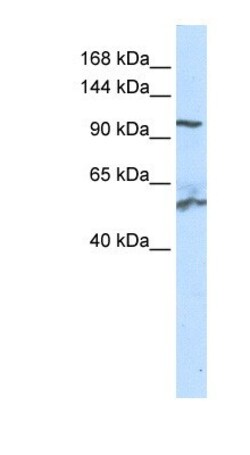 NNT Antibody, Novus Biologicals 100&mu;L; Unlabeled:Antibodies, Polyclonal