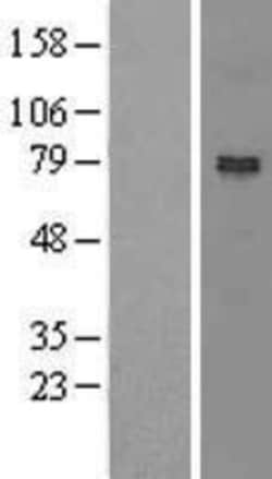 Novus Biologicals&trade;&nbsp;NOA1 Overexpression Lysate