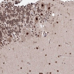 NOA1 Antibody, Novus Biologicals:Antibodies:Primary Antibodies