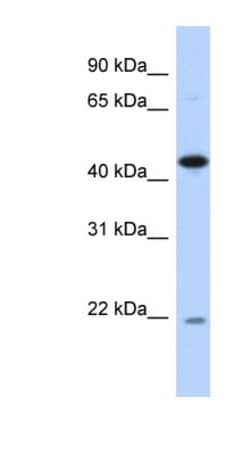 NOB1 Antibody, Novus Biologicals 100&mu;L; Unlabeled:Antibodies, Polyclonal