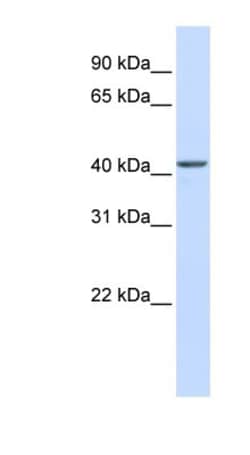 NOB1 Antibody, Novus Biologicals 100 &mu;L | Buy Online | Novus Biologicals | Fisher Scientific