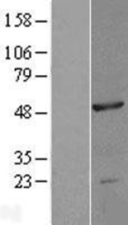 Novus Biologicals&trade;&nbsp;NOB1 Overexpression Lysate
