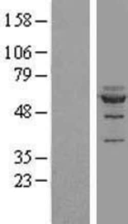 Novus Biologicals&trade;&nbsp;NOC4L Overexpression Lysate