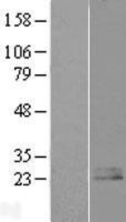 Novus Biologicals™ Nociceptin Overexpression Lysate