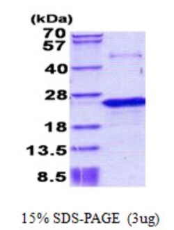 Novus Biologicals Recombinant Human Nociceptin His Protein 0.1 mg | Buy Online | Novus Biologicals&trade; | Fisher Scientific