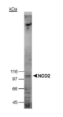 Novus Biologicals NOD2 Antibody Pack 2 vials:Antibodies