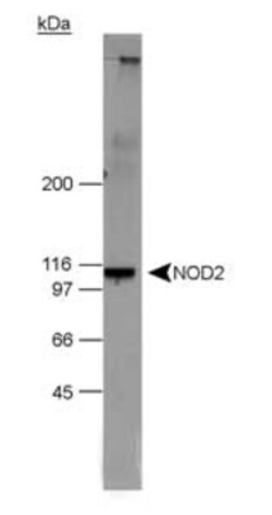 Novus Biologicals NOD2 Antibody Pack 2 vials:Antibodies
