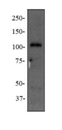 NOD2 Antibody (2D9) - BSA Free, Novus Biologicals 0.1mL; Unlabeled:Antibodies,