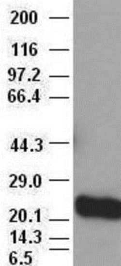 Noggin Antibody (OTI1H8), Novus Biologicals 0.1mL; Unlabeled:Antibodies,