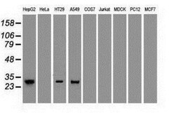 Noggin Antibody (OTI1H8), Novus Biologicals 0.1mL; Unlabeled:Antibodies,
