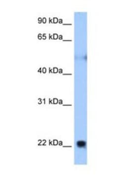 Nogo Antibody, Novus Biologicals 0.05mg; Unlabeled:Antibodies, Polyclonal