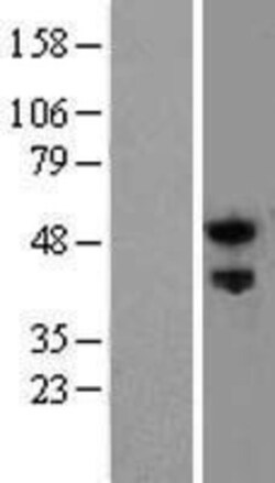 Novus Biologicals&trade;&nbsp;Nogo Receptor/NgR Overexpression Lysate