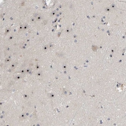 NOL11 Antibody, Novus Biologicals 0.1mL; Unlabeled:Antibodies, Polyclonal