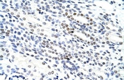 NOL4 Antibody, Novus Biologicals 100&mu;L; Unlabeled:Antibodies, Polyclonal