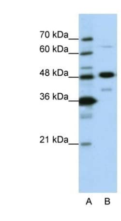 NOL4 Antibody, Novus Biologicals 100&mu;L; Unlabeled:Antibodies, Polyclonal