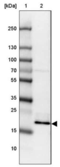 NOLA1 Antibody, Novus Biologicals 25 &mu;L | Buy Online | Novus Biologicals | Fisher Scientific