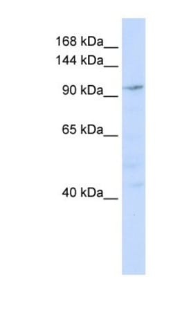 NOMO1 Antibody, Novus Biologicals 100&mu;L; Unlabeled:Antibodies, Polyclonal