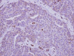 non-muscle Myosin IIA Antibody, Novus Biologicals 0.1mL; Unlabeled:Antibodies,