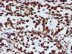 NONO Antibody (OTI4D9), Novus Biologicals 0.1 mL | Buy Online | Novus Biologicals | Fisher Scientific