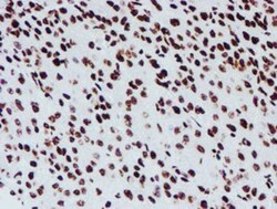 NONO Antibody (OTI4D9), Novus Biologicals 0.1 mL | Buy Online | Novus Biologicals | Fisher Scientific