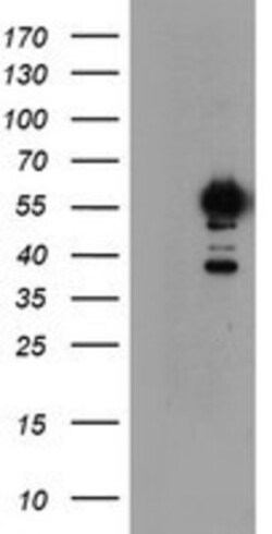 NONO Antibody (OTI4D9), Novus Biologicals 0.1 mL | Buy Online | Novus Biologicals | Fisher Scientific