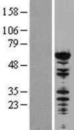 Novus Biologicals&trade;&nbsp;NONO Overexpression Lysate