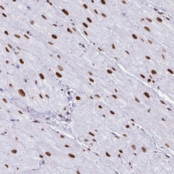 NONO Antibody, Novus Biologicals 25 &mu;L, Unlabeled:Antibodies, Polyclonal