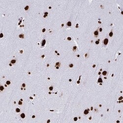 NONO Antibody, Novus Biologicals 0.1mL; Unlabeled:Antibodies, Polyclonal