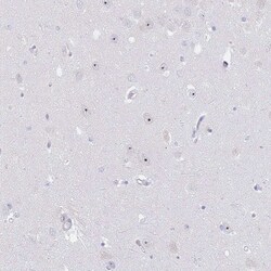 NOP14 Antibody, Novus Biologicals 0.1mL; Unlabeled:Antibodies, Polyclonal