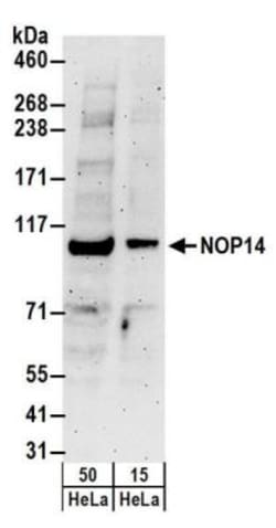 NOP14 Antibody, Novus Biologicals 0.1mg; Unlabeled:Anticuerpos