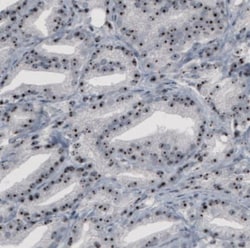 NOP56 Antibody (CL2603), Novus Biologicals 0.1mL; Unlabeled:Antibodies,