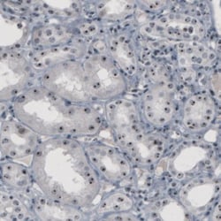 NOP56 Antibody (CL2603), Novus Biologicals 0.1mL; Unlabeled:Antibodies,