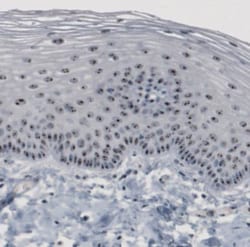 NOP56 Antibody (CL2603), Novus Biologicals 0.1mL; Unlabeled:Antibodies,