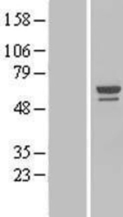 Novus Biologicals&trade;&nbsp;NOP58 Overexpression Lysate