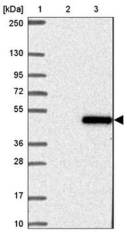 NOR1/OSCP1 Antibody, Novus Biologicals 25 &mu;L; Unlabeled:Antibodies,