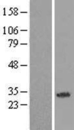 Novus Biologicals™ NORE1 Overexpression Lysate