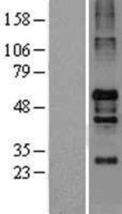 Novus Biologicals&trade;&nbsp;NOS1AP Overexpression Lysate