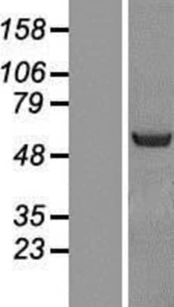 Novus Biologicals&trade;&nbsp;NOSTRIN Overexpression Lysate
