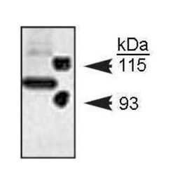 Notch-1 Antibody - (Cleaved N terminal), Novus Biologicals 0.2mL; Unlabeled:Antibodies,