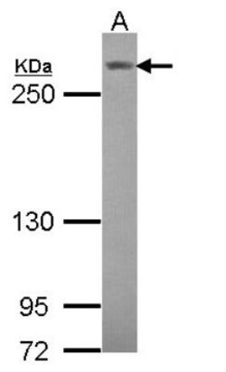 Notch-3 Antibody, Novus Biologicals 0.1mL; Unlabeled:Antibodies, Polyclonal