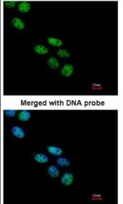 Nova1 Antibody, Novus Biologicals 0.1mL; Unlabeled:Antibodies, Polyclonal