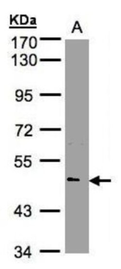 Nova1 Antibody, Novus Biologicals 0.1mL; Unlabeled:Antibodies, Polyclonal
