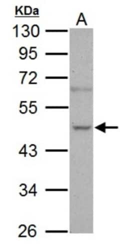 Nova1 Antibody, Novus Biologicals 0.1mL; Unlabeled:Antibodies, Polyclonal