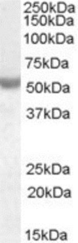 Nova1 Antibody, Novus Biologicals 0.1mg; Unlabeled:Antibodies, Polyclonal