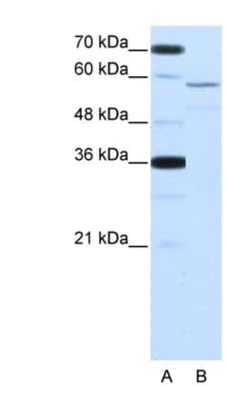 Nova2 Antibody, Novus Biologicals 0.1mg; Unlabeled:Antibodies, Polyclonal